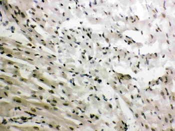 Glucocorticoid Receptor/NR3C1 Rabbit Polyclonal Antibody