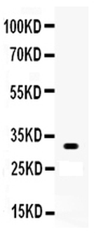 Otx2 Rabbit Polyclonal Antibody
