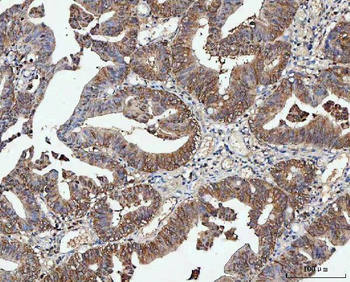 PP2A-alpha/PPP2CA Antibody