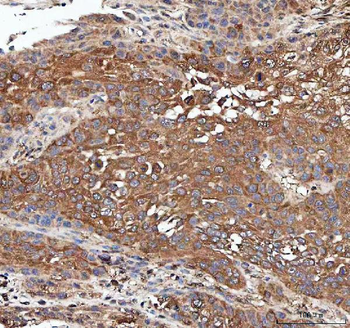 PP2A-alpha/PPP2CA Antibody