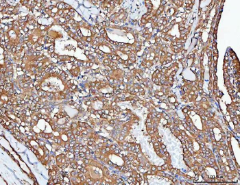 PP2A-alpha/PPP2CA Antibody