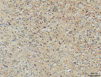 PP2A-alpha/PPP2CA Antibody