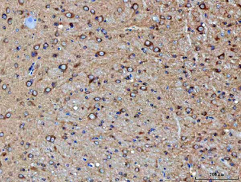 PP2A-alpha/PPP2CA Antibody