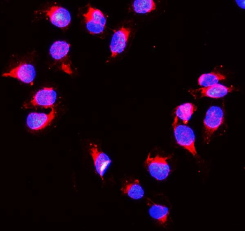 Peroxiredoxin 1/PRDX1 Antibody