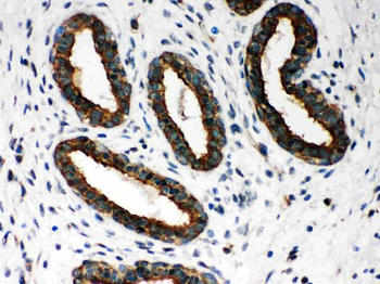 Peroxiredoxin 1/PRDX1 Antibody