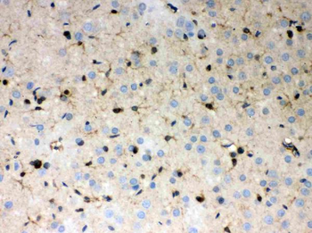 Peroxiredoxin 1/PRDX1 Antibody