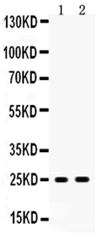 PSCA Rabbit Polyclonal Antibody