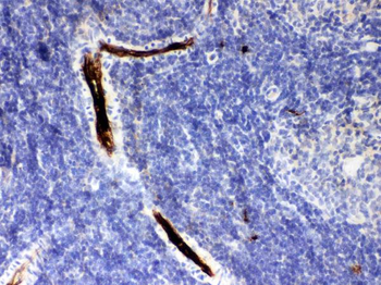 alpha 1 Antitrypsin/SERPINA1 Rabbit Polyclonal Antibody