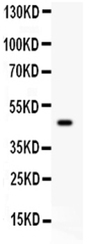 SerpinB2 Rabbit Polyclonal Antibody