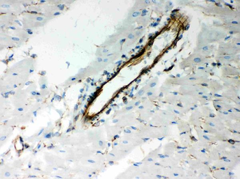 Vimentin Antibody
