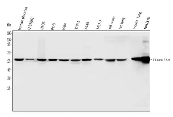 Vimentin Antibody
