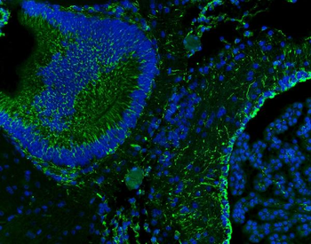 Vimentin Antibody
