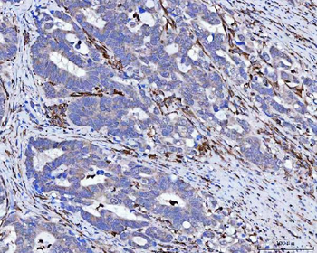 Vimentin Antibody