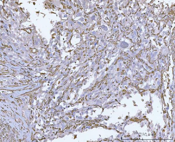 Vimentin Antibody