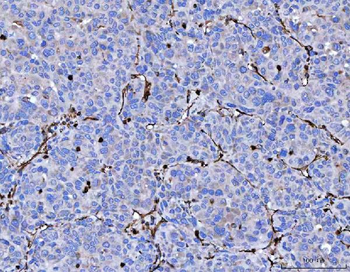Vimentin Antibody