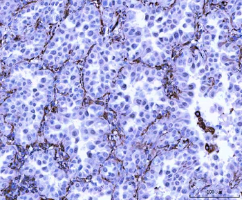 Vimentin Antibody