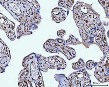 Vimentin Antibody