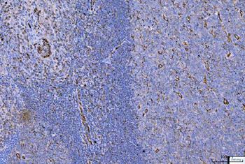 Vimentin Antibody