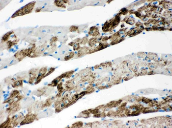 AIF/AIFM1 Antibody