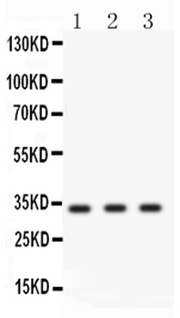 Cyclin D1/CCND1 Rabbit Polyclonal Antibody