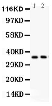 FRZB Rabbit Polyclonal Antibody