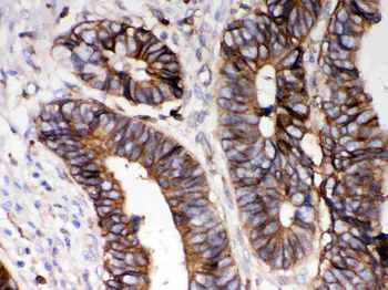 HLA A/HLA-A Rabbit Polyclonal Antibody