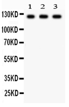 Phospholipase D1/PLD1 Rabbit Polyclonal Antibody