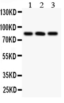 Calcineurin A/PPP3CA Rabbit Polyclonal Antibody