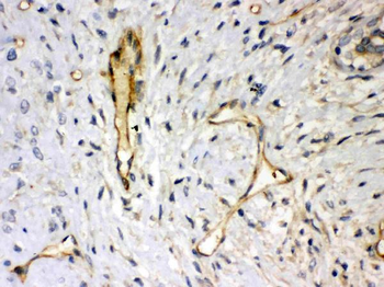 Syndecan 4/SDC4 Rabbit Polyclonal Antibody