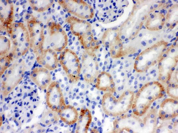 SLC22A2 Antibody