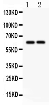 SLC22A2 Antibody