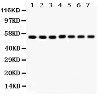 SMAD1 Rabbit Polyclonal Antibody