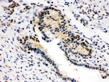 SMN1/2 Rabbit Polyclonal Antibody