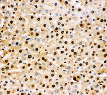Superoxide Dismutase 1/SOD1 Antibody