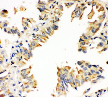 Superoxide Dismutase 1/SOD1 Antibody