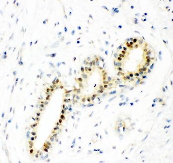 Superoxide Dismutase 1/SOD1 Antibody