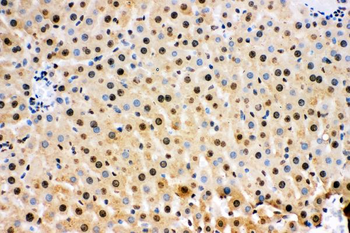 Superoxide Dismutase 1/SOD1 Antibody