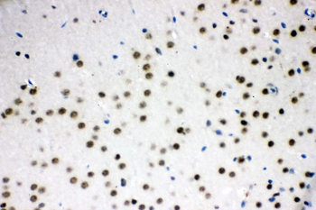 SF2/SRSF1 Rabbit Polyclonal Antibody