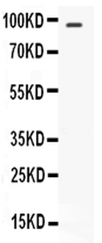 STAT6 Antibody