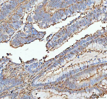 Actin/ACTA1 Antibody