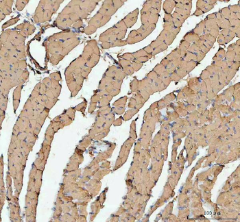Actin/ACTA1 Antibody