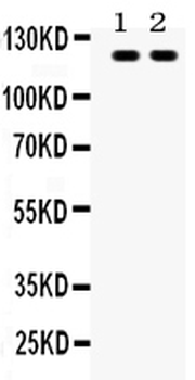Toll-like receptor 8 TLR8 Rabbit Polyclonal Antibody
