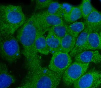 SSH3BP1/ABI1 Rabbit Polyclonal Antibody