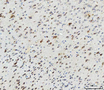 SSH3BP1/ABI1 Rabbit Polyclonal Antibody