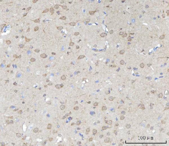 SSH3BP1/ABI1 Rabbit Polyclonal Antibody