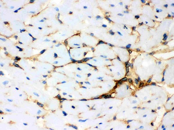 Annexin A3/ANXA3 Antibody