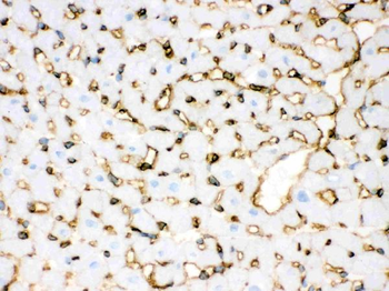 Annexin A3/ANXA3 Antibody