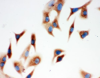 Annexin A3/ANXA3 Antibody