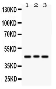 Ataxin 3/ATXN3 Antibody