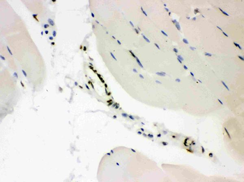 CTBP2 Antibody